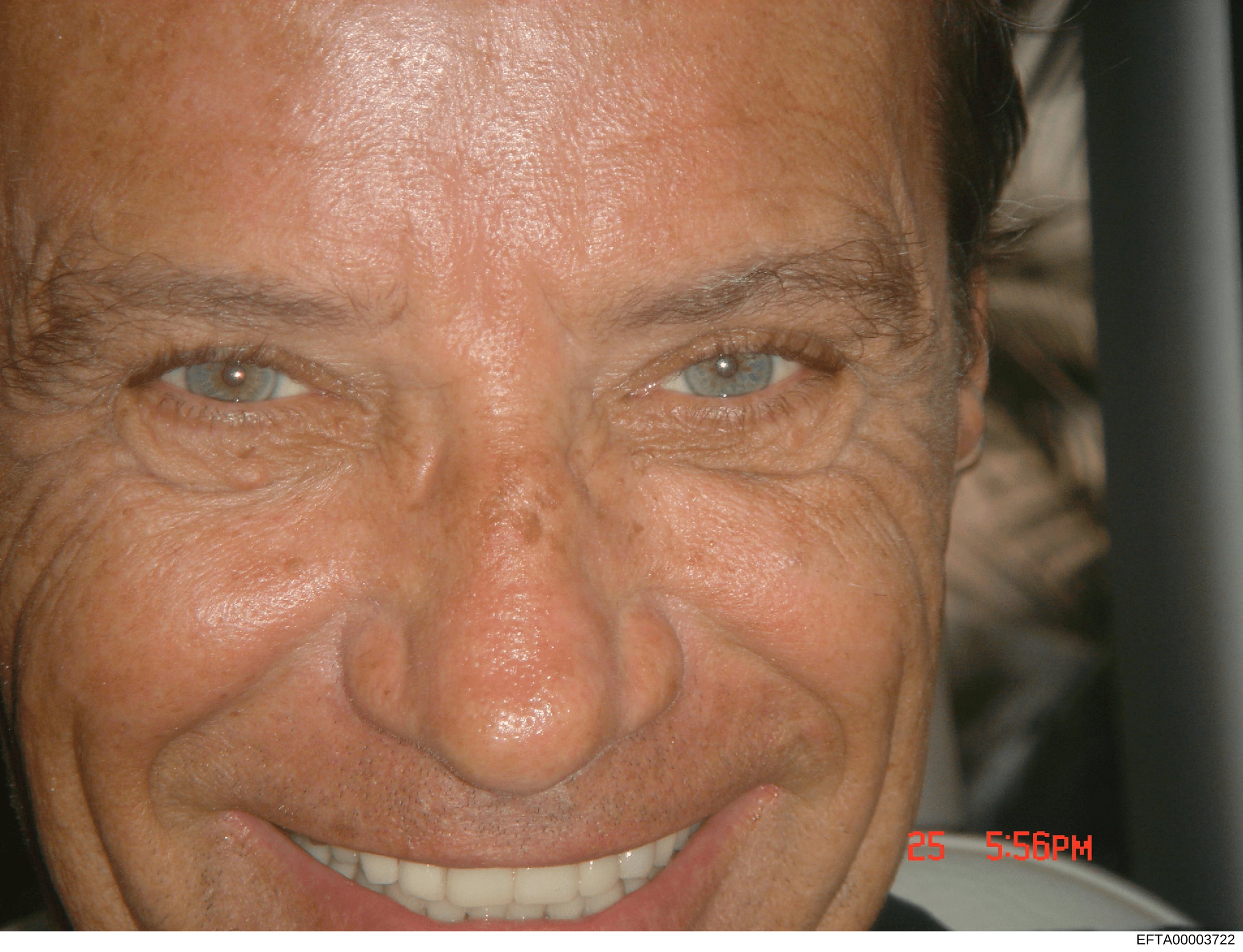 This is a close-up photograph of a male subject's face, taken indoors. The image shows facial features in detail and includes a timestamp reading '25 5:56PM' in the lower right corner. The photograph's purpose within the investigation context is uncl