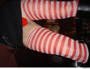 This is an evidence photograph showing red and white striped hosiery or stockings on a person's legs. The image appears to be taken indoors in what looks like a residential or hospitality setting, with dark furnishings visible in the background. The 